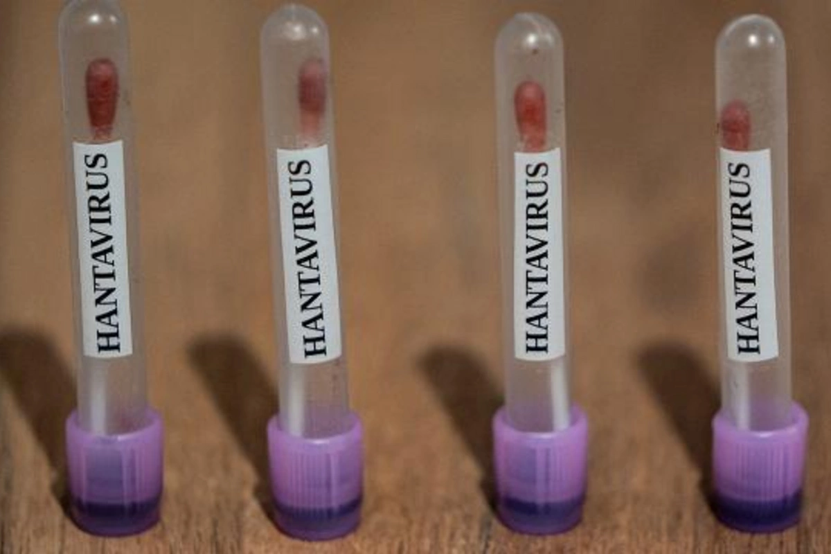 ABŞ hantavirus hallarını 