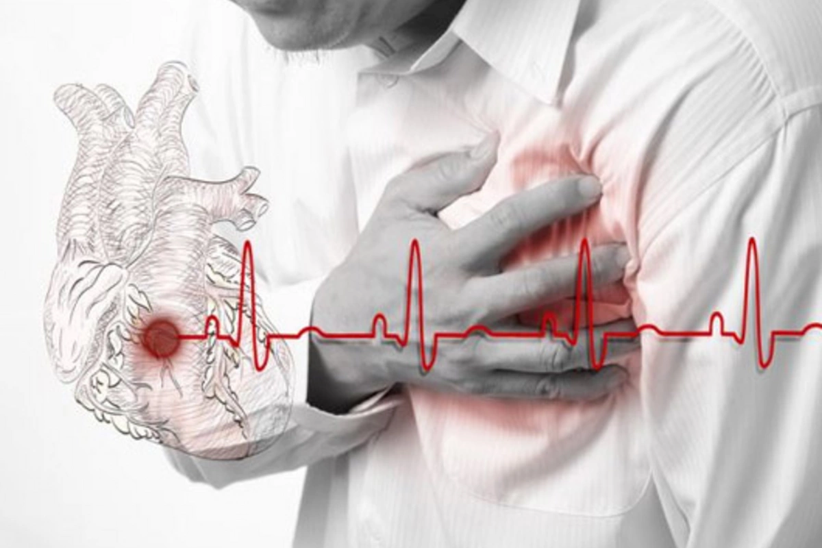Alimlər infarkt və insultun qarşısını almağın yeni yolunu KƏŞF ETDİ - Bu dərmanla… Alimlər infarkt və insultun qarşısını almağın yeni yolunu KƏŞF ETDİ - Bu dərmanla…