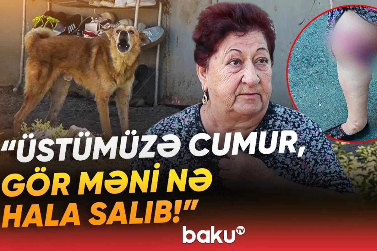 Əhali dəhşət içində: Sahibsiz itlər 75 yaşlı qadını dişləyib Əhali dəhşət içində: Sahibsiz itlər 75 yaşlı qadını dişləyib
