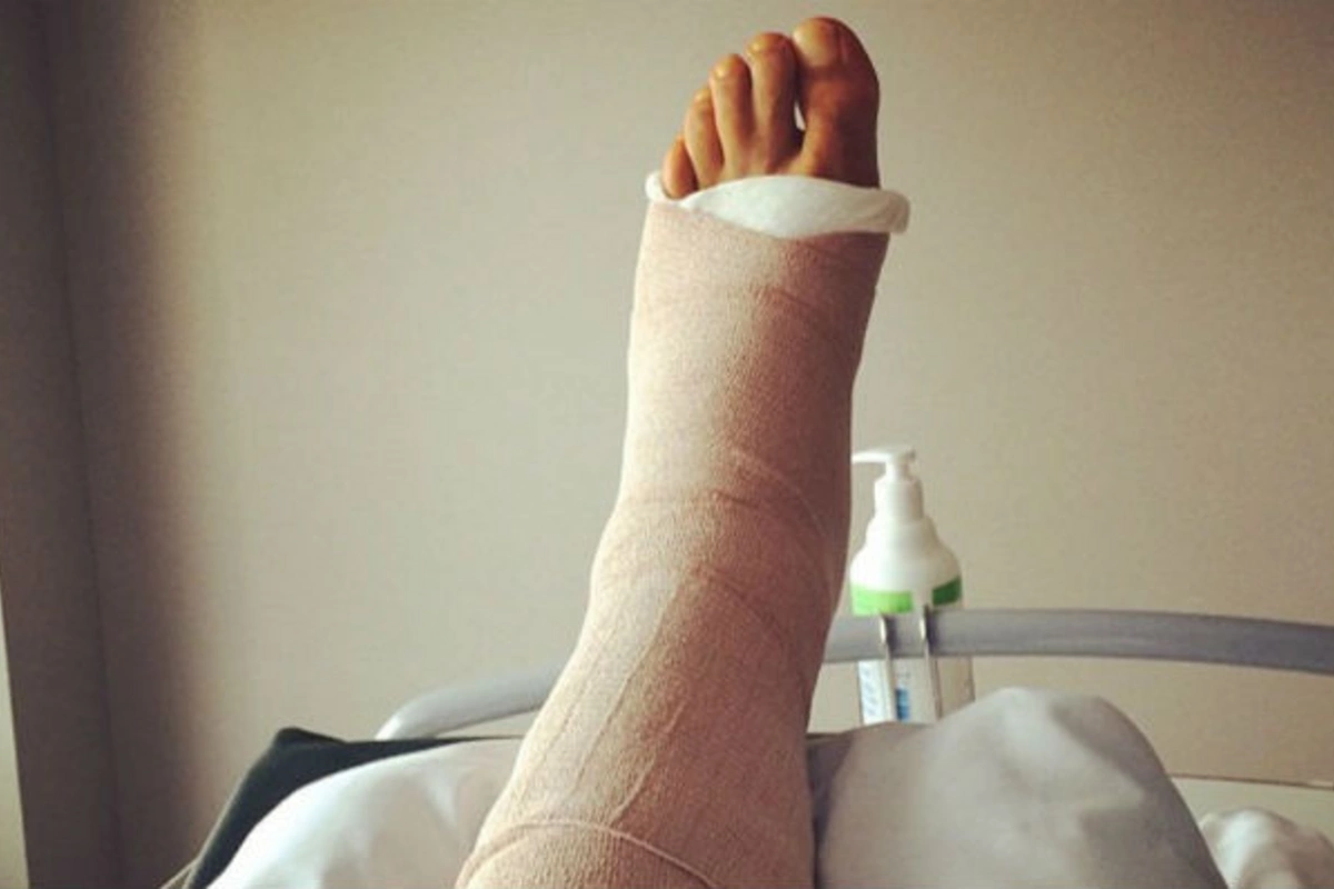 TƏBİB Sabunçu Tibb Mərkəzində pasiyentin öz hesabına gips alması iddialarına aydınlıq gətirdi