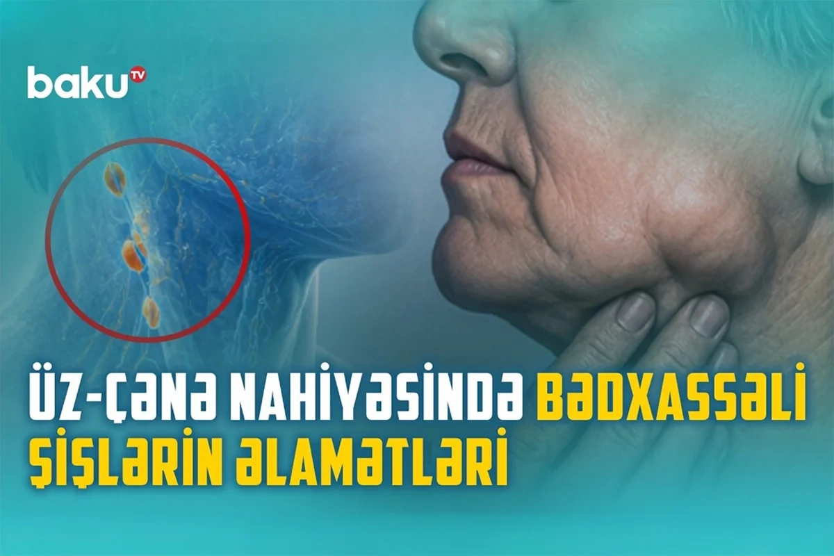 Üz-çənə travmaları və infeksiyaları necə yaranır: Çeynəmə, danışma zamanı ağrı varsa... Üz-çənə travmaları və infeksiyaları necə yaranır: Çeynəmə, danışma zamanı ağrı varsa...